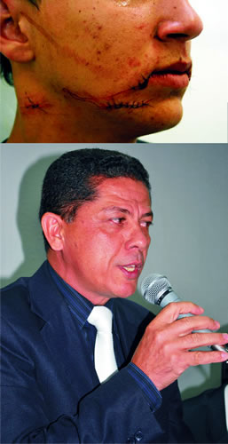 Vereador quer Aparecida livre do perigo de cerol